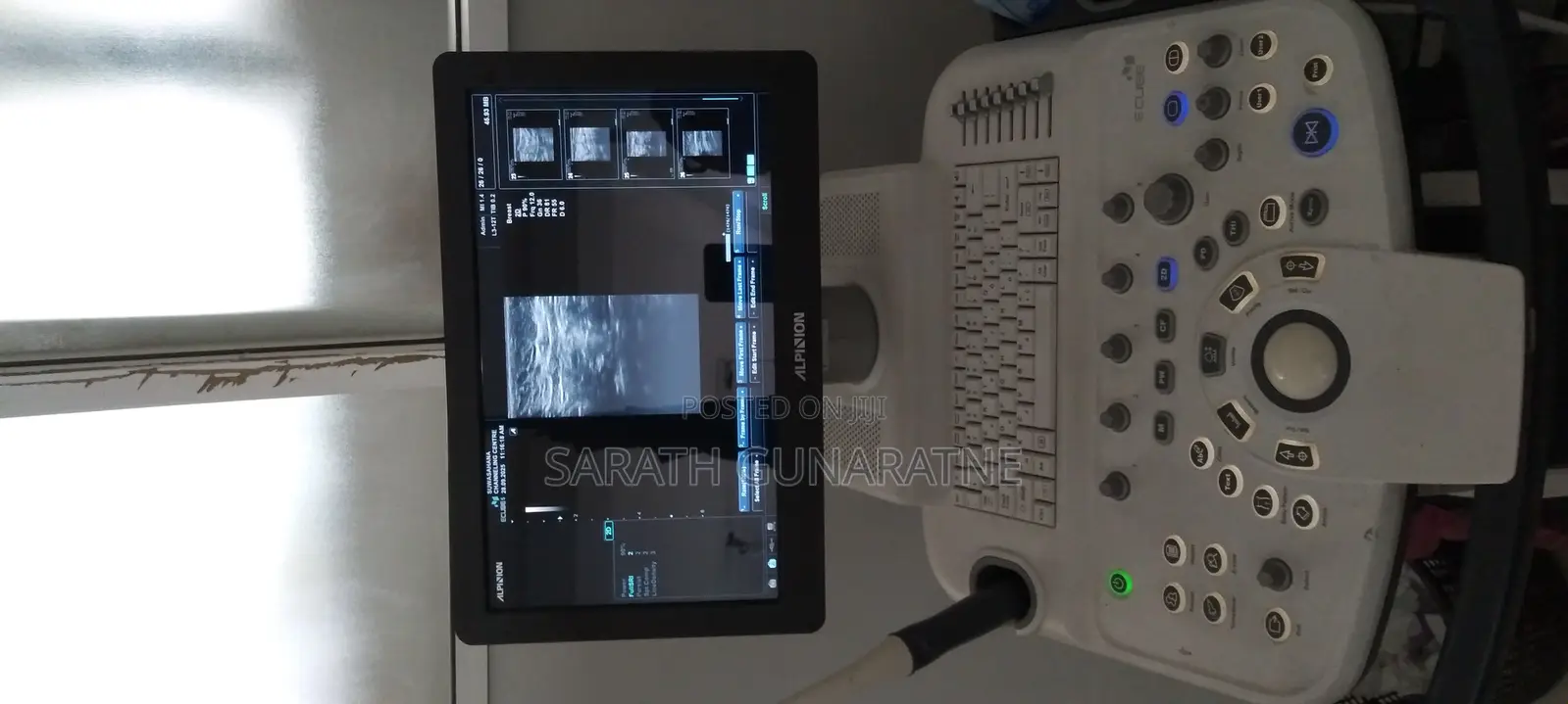 Ultrasound Medical Scan Machine for Sale