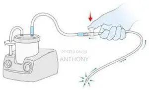 Sterile Suction Catheter Thumb Control