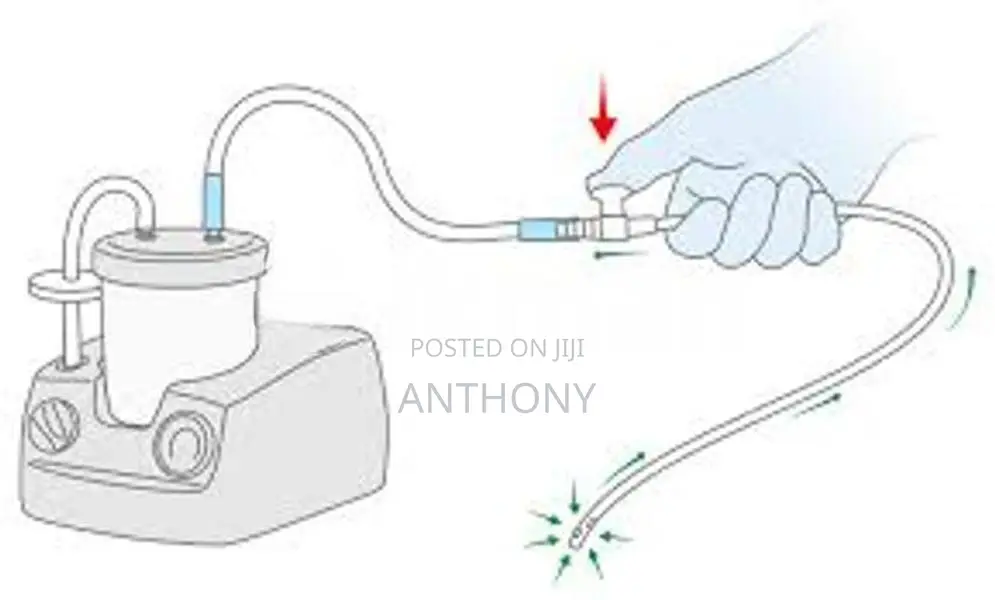 Sterile Suction Catheter Thumb Control