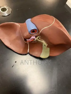 Liver Model A469