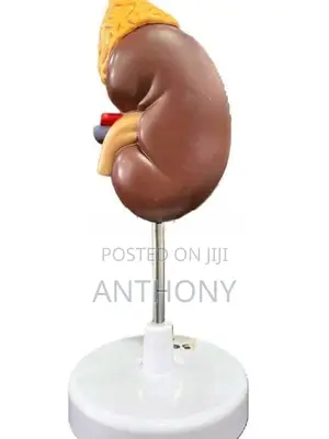 Kidney With Adrenal Gland A561-1