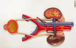 Relief Model of Urinary System A568