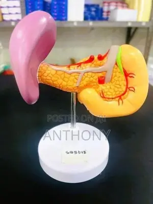 Pancreas, Duodenum and Spleen A470