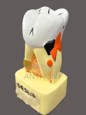 Diseased Tooth Model A540