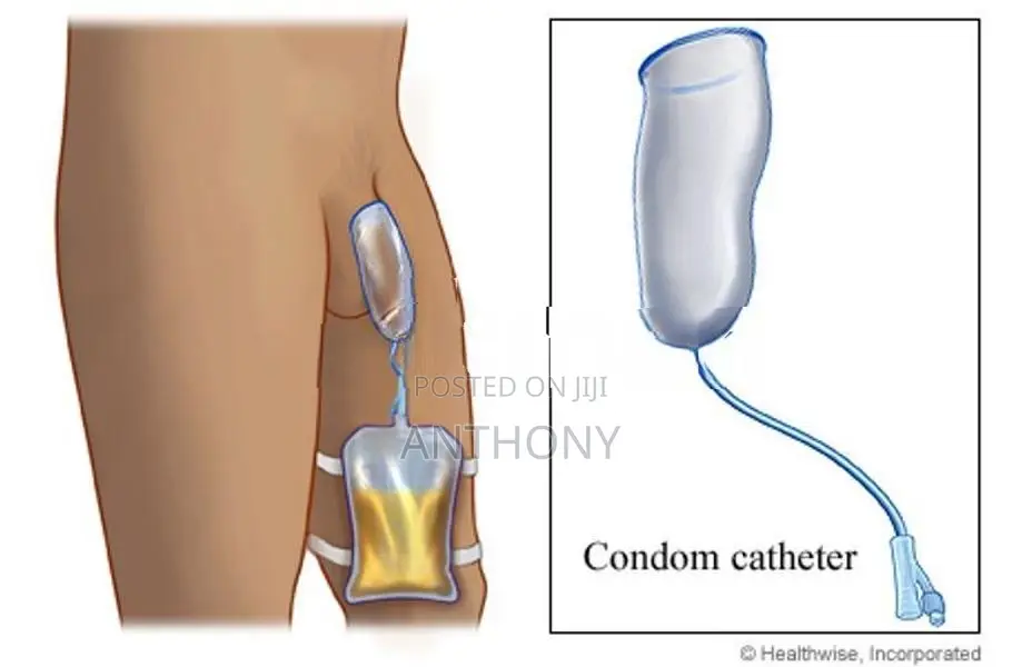Condom Catheter