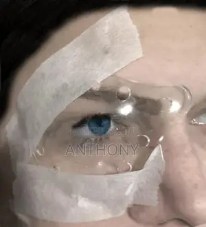 EYE SHIELD.
