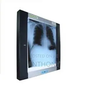 X -Ray Film Viewer (Ssingle)