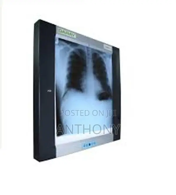 X -Ray Film Viewer (Ssingle)