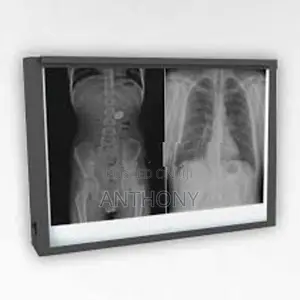X-Ray Film Viewer (Double)