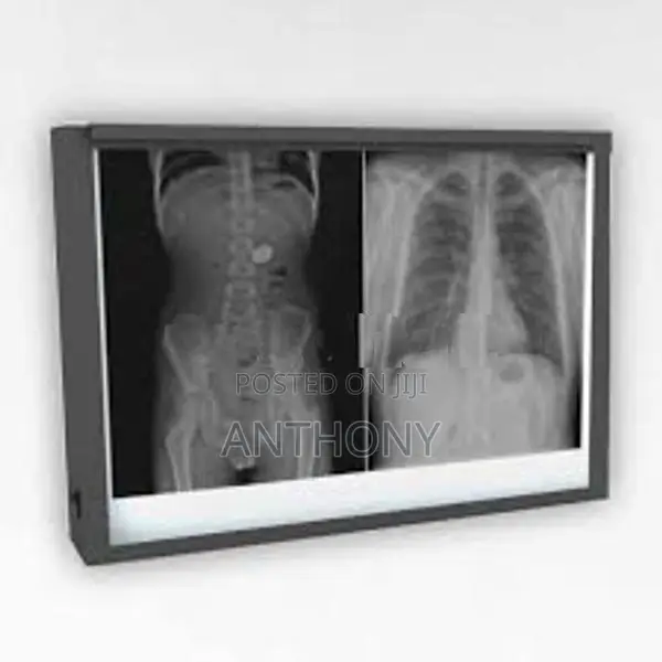 X-Ray Film Viewer (Double)