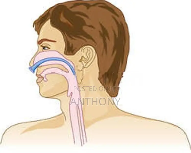 Nasopharyngeal Airway