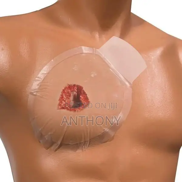 CHEST SEAL