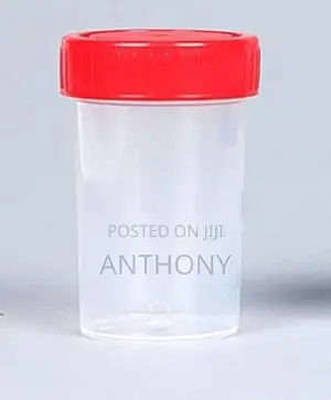 URINE CONTAINER 60ML