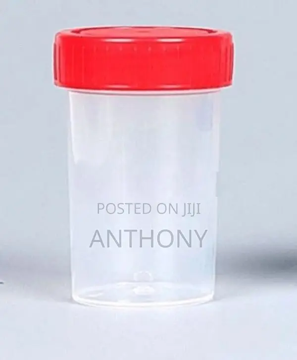 URINE CONTAINER 60ML
