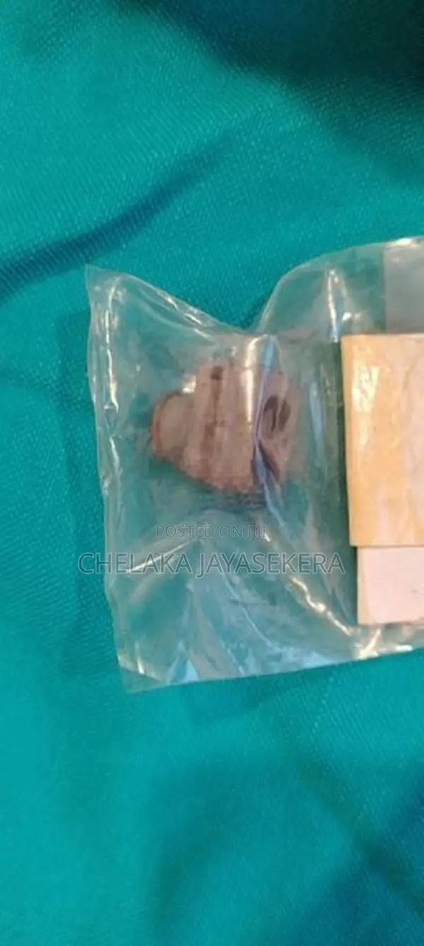 A1299974681 Genuine Mercedes-Benz OEM Grommet
