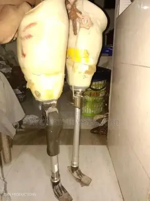 Artificial Limb
