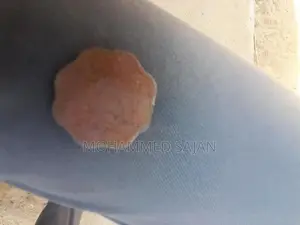Old Coin