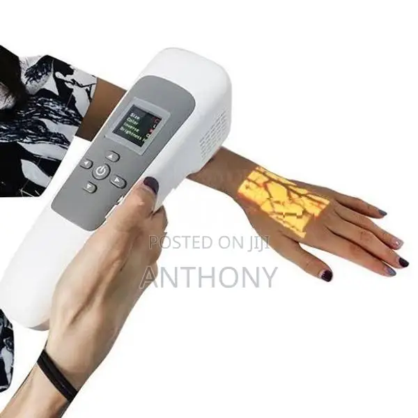 SY-G090S Portable Vein Finder
