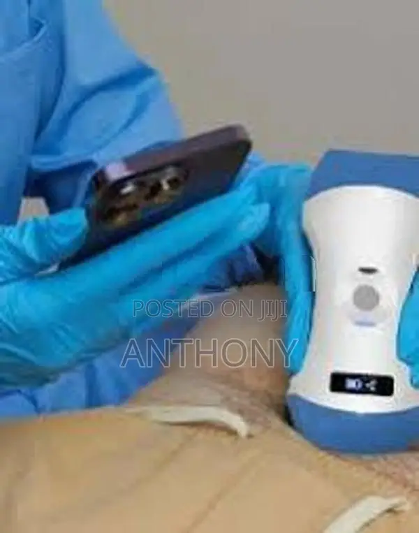 Wireless Ultrasound Probe – 3-in-1 Pocket Device