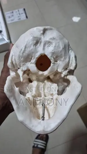 skull