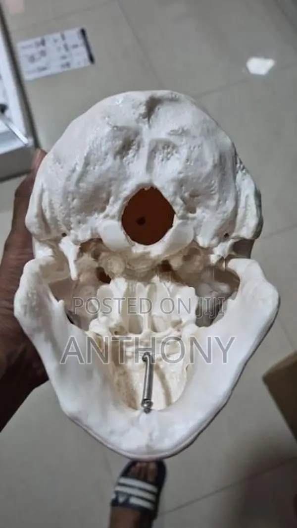 skull