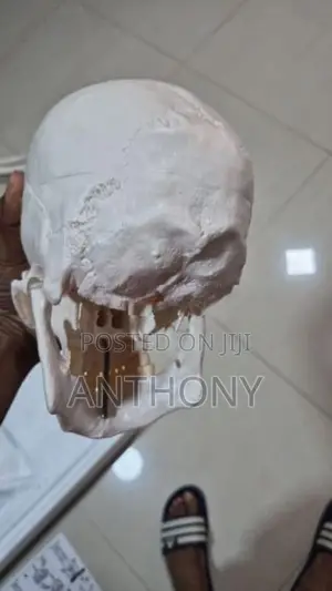 skull